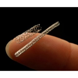 Bioabsorbable Ureteral Stent