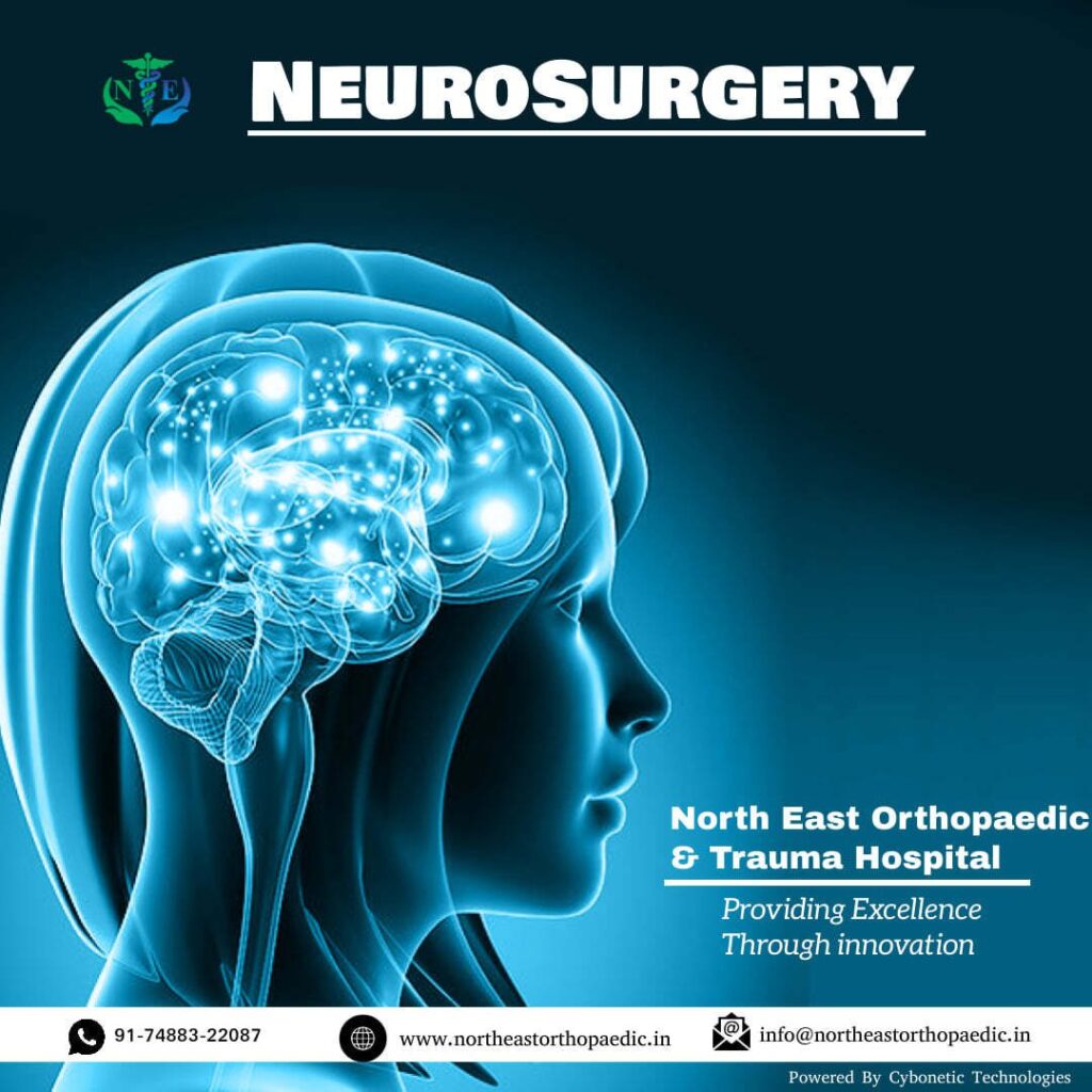 Best Neuro Hospital in Patna, Best neuro doctor in Patna, best neurosurgeon in patna, neuro surgery in patna , neuro hospital in patna, best neurosurgeon doctor in patna