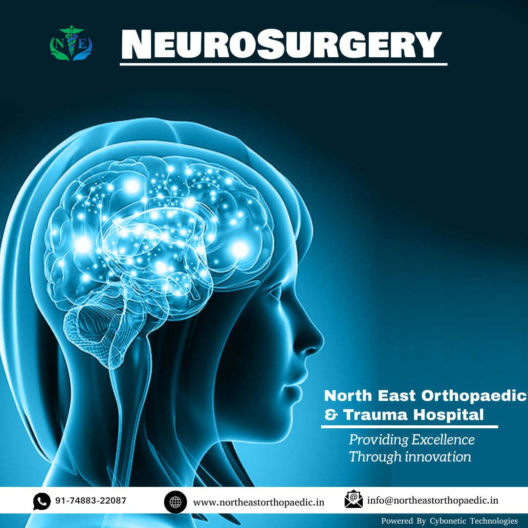 Best Neuro Hospital in Patna, Best neuro doctor in Patna, best neurosurgeon in patna, neuro surgery in patna , neuro hospital in patna, best neurosurgeon doctor in patna