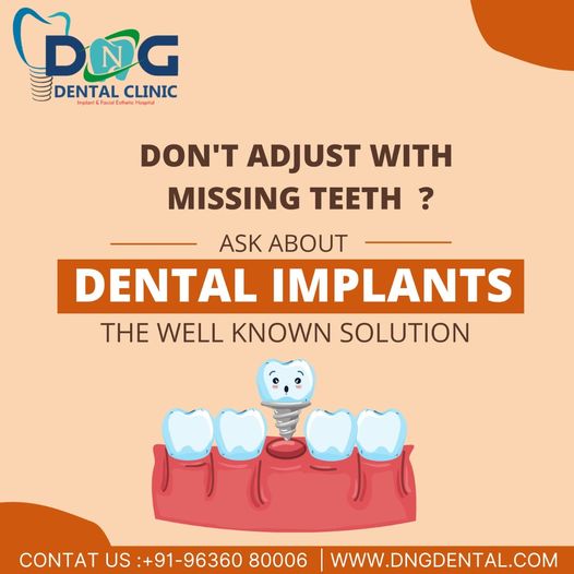 dental implant jaipur