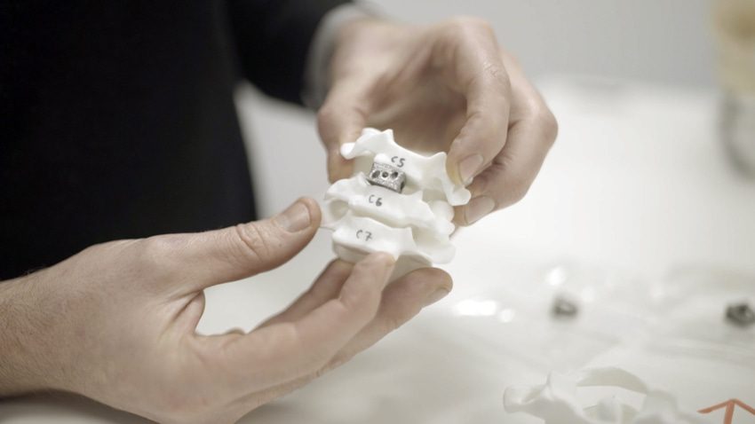 Spinal Implants
