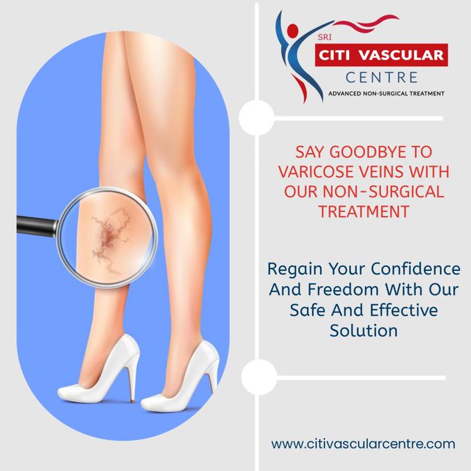 best varicose veins hospital in hyderabad