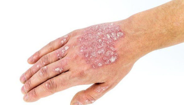 dermatologist Mission Viejo CA