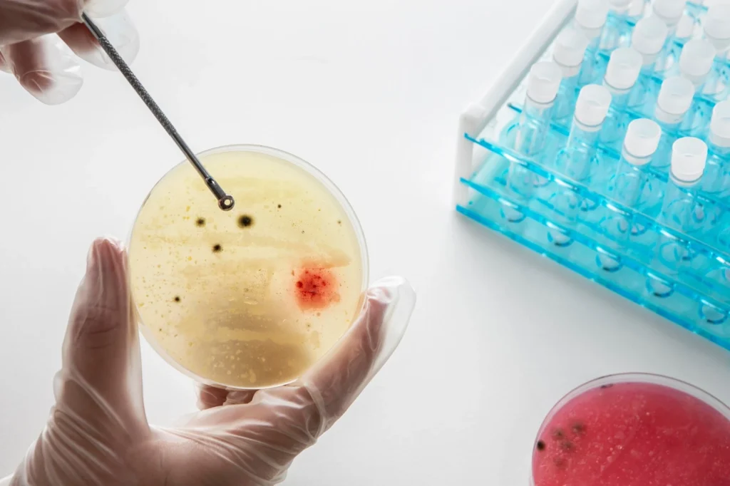 Immunoblot Western Blot