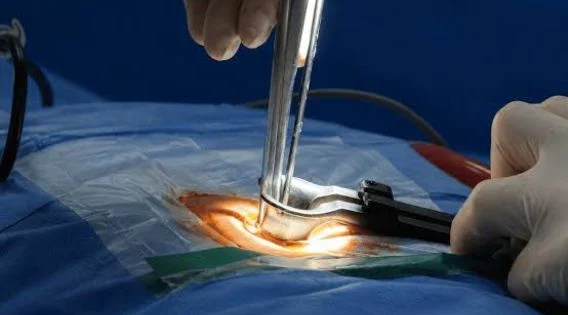 Minimally Invasive Spine Surgery Recovery Time: Consult the Top Spine Surgeon in Kolkata, India
